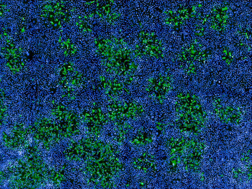 Cellules humaines infectées par MPXV (en vert) parmi des cellules non infectées (noyaux en bleu). Image prise au microscope confocal